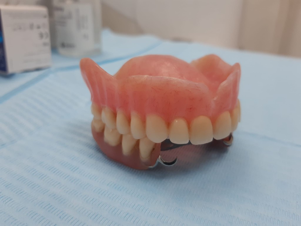 Chrome partial with full denture