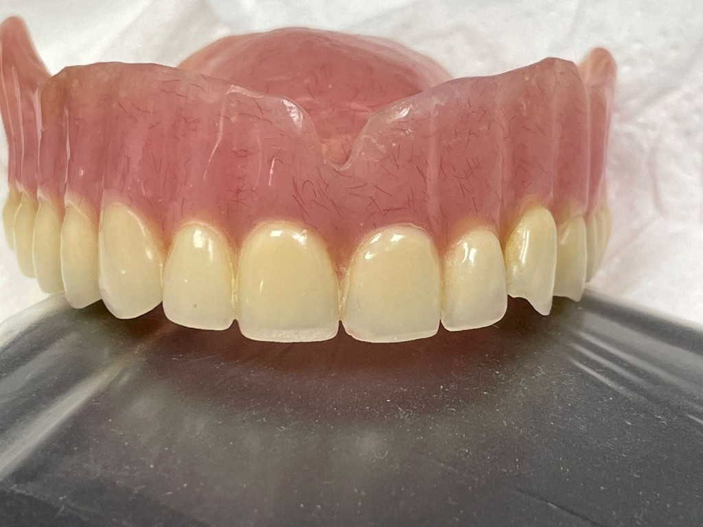 Full arch denture showing finish and gum detail