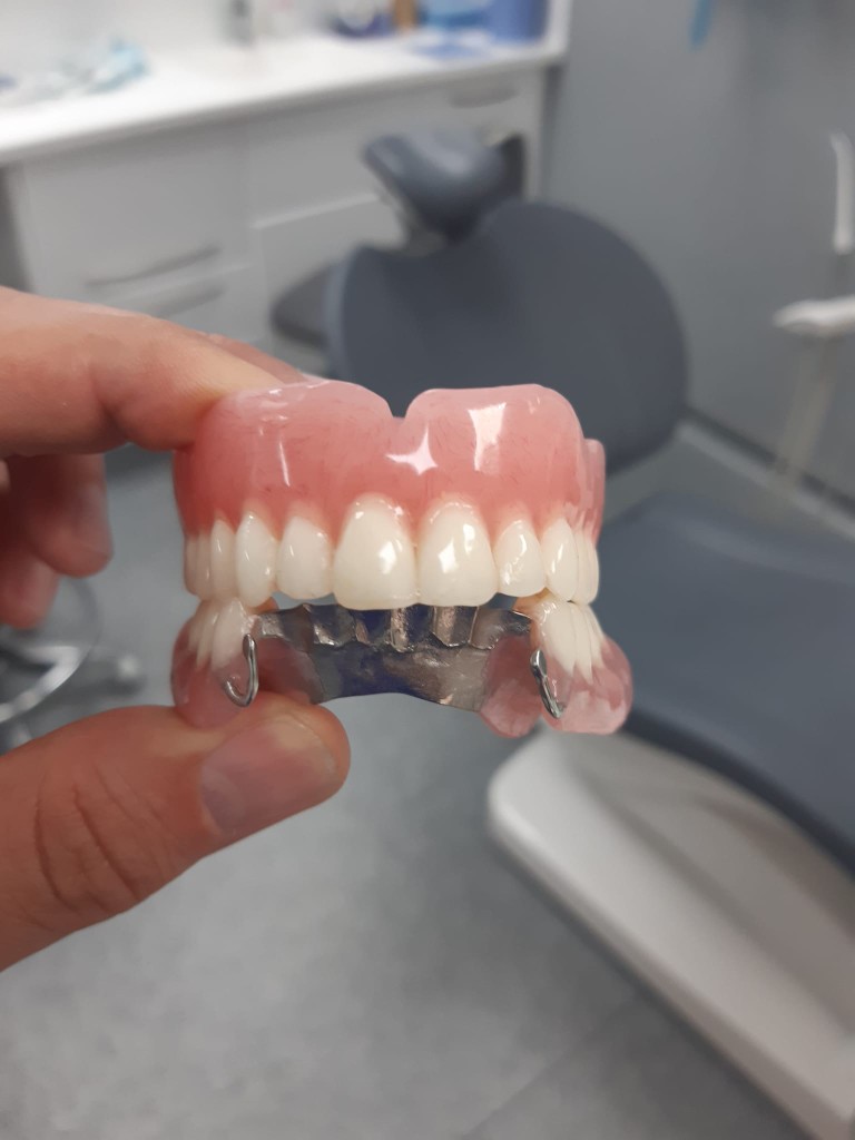 Full upper denture