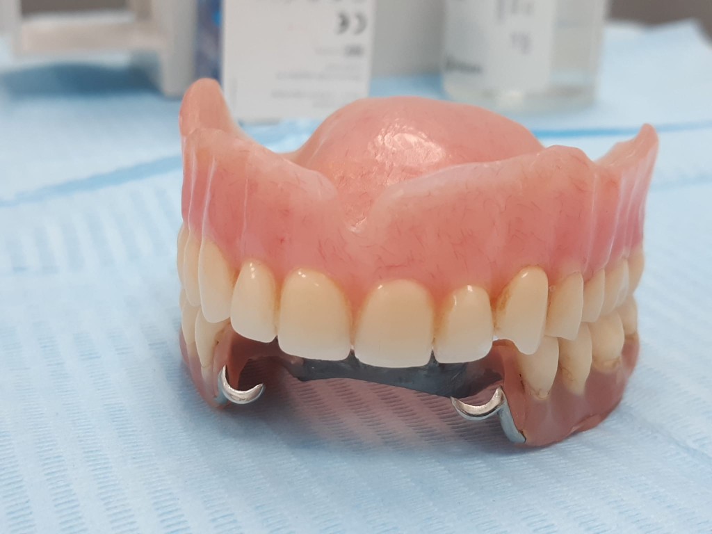 Full upper denture and metal-based partial lower on a clinical blue surface