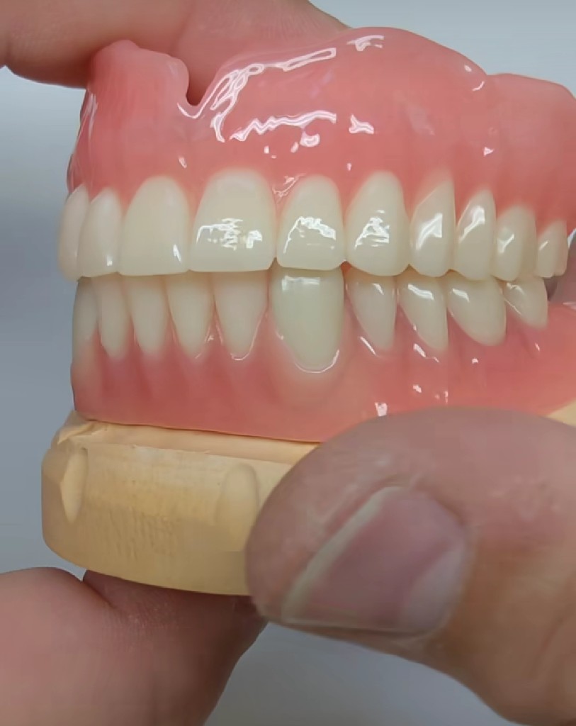 Upper and lower dentures together in bite on a dental model
