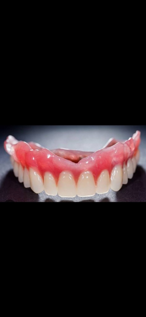 Full upper denture with pink gums on a dark studio background